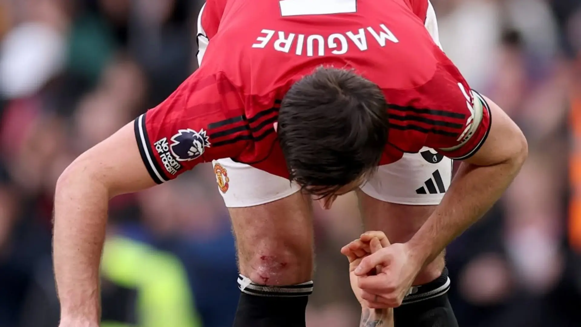 Rahasia Clean Sheet Manchester United Harry Maguire Redam Erling Haaland Meski Lutut Berdarah